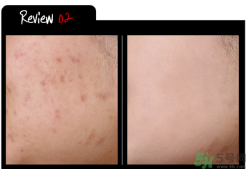 w.labѩ�������ɫ����ô����w.labѩ�������ɫ�Ͱ�ɫ����